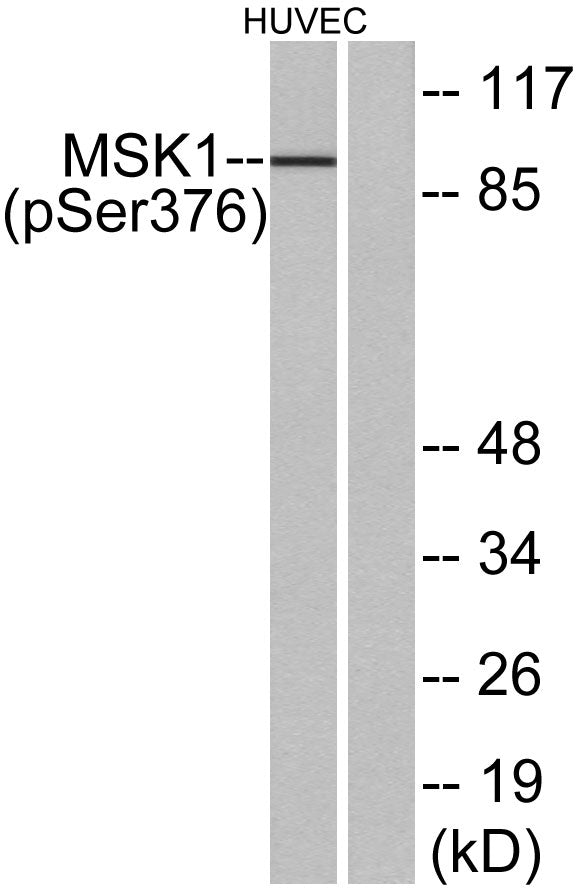 MSK1 (phospho Ser376) Rabbit Polyclonal Antibody