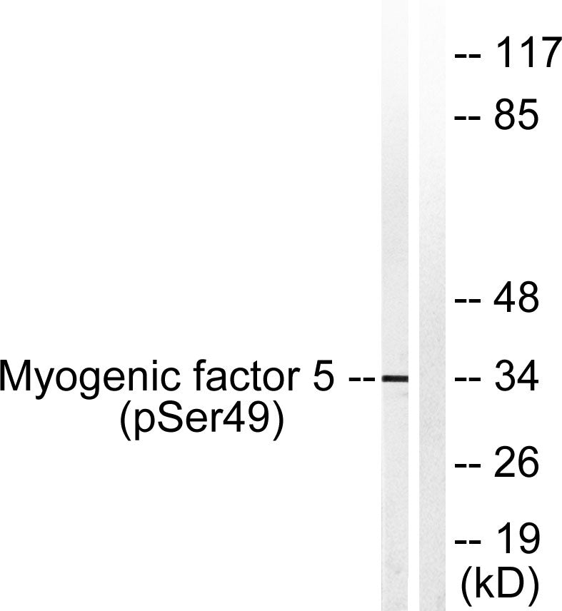 Myf-5 (phospho Ser49) Rabbit Polyclonal Antibody