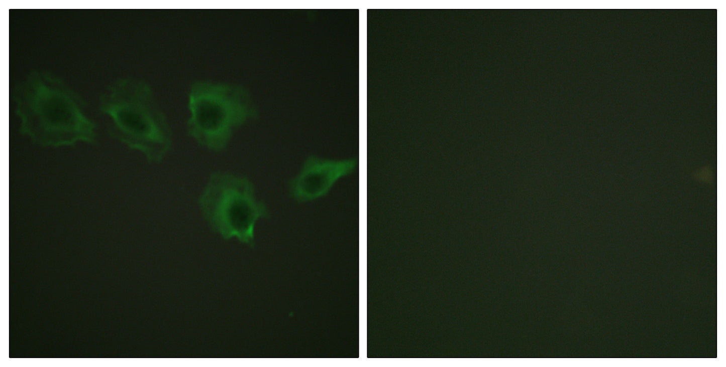 MYPT1 (phospho Thr696) Rabbit Polyclonal Antibody