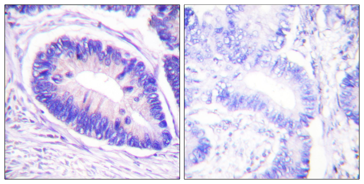 MYPT1 (phospho Thr853) Rabbit Polyclonal Antibody