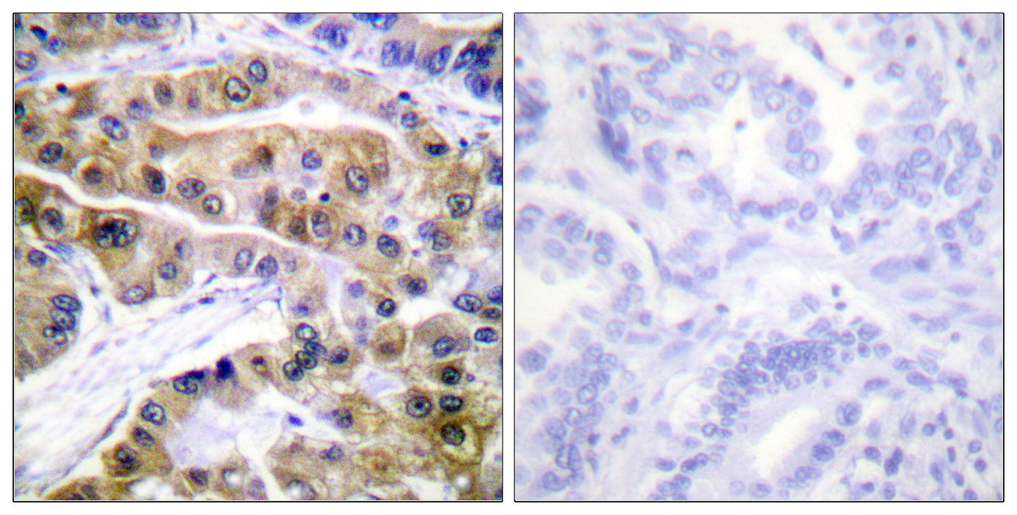 Na+/K+-ATPase α1 (phospho Ser16) Rabbit Polyclonal Antibody