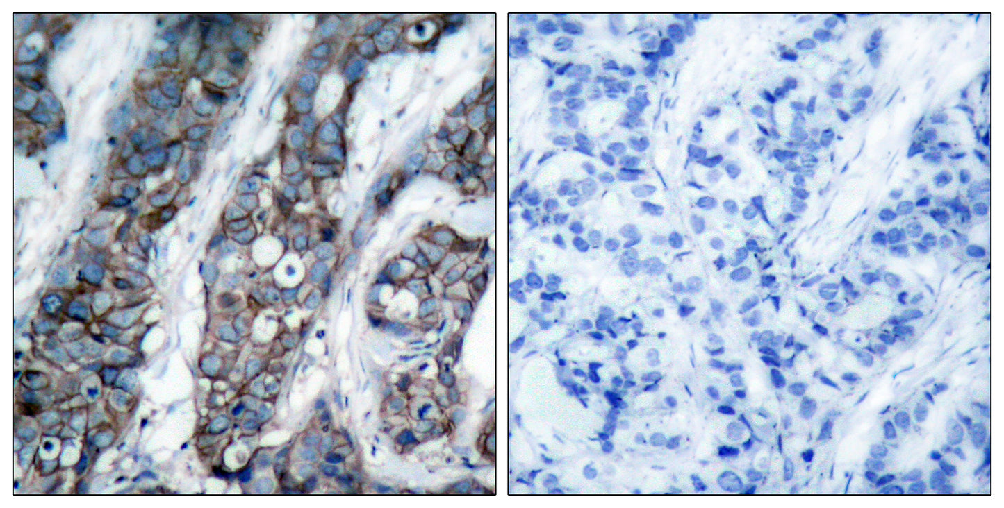 Neu (phospho Tyr1248) Rabbit Polyclonal Antibody