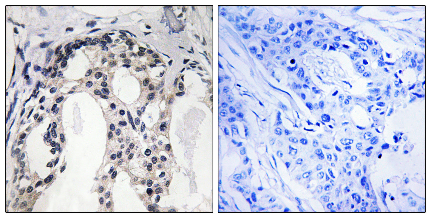 NF2 (phospho Ser10) Rabbit Polyclonal Antibody