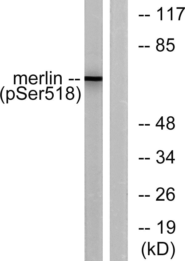 NF2 (phospho Ser518) Rabbit Polyclonal Antibody