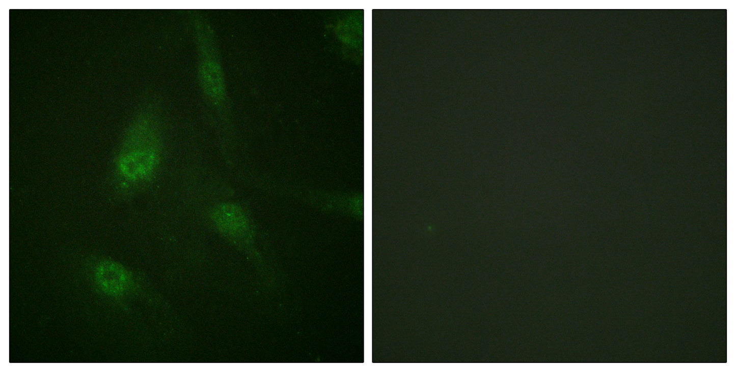 NFATc3 (phospho Ser165) Rabbit Polyclonal Antibody