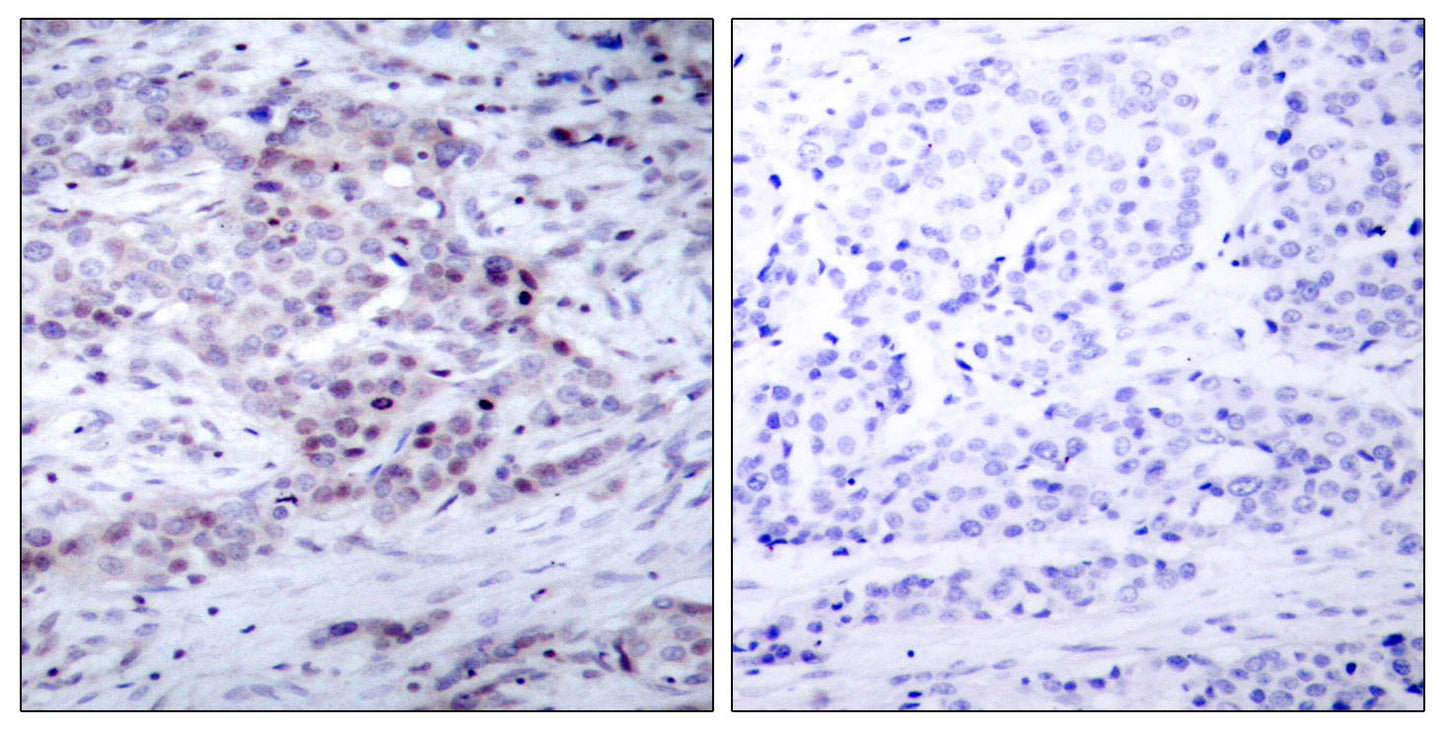 NFκB-p100 (phospho Ser869) Rabbit Polyclonal Antibody