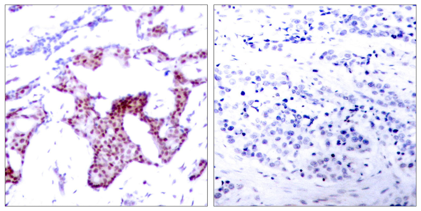 NFκB-p65 (phospho Ser276) Rabbit Polyclonal Antibody
