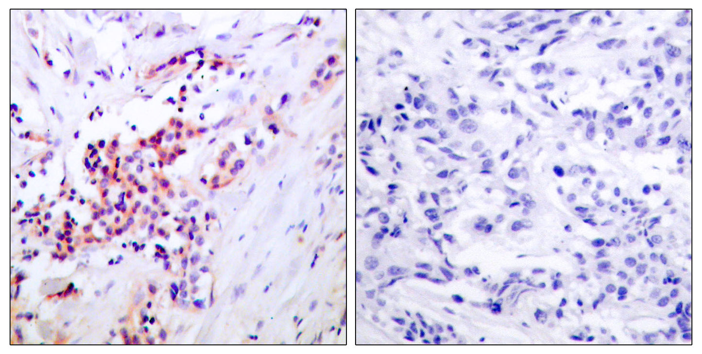 NFκB-p65 (phospho Ser468) Rabbit Polyclonal Antibody