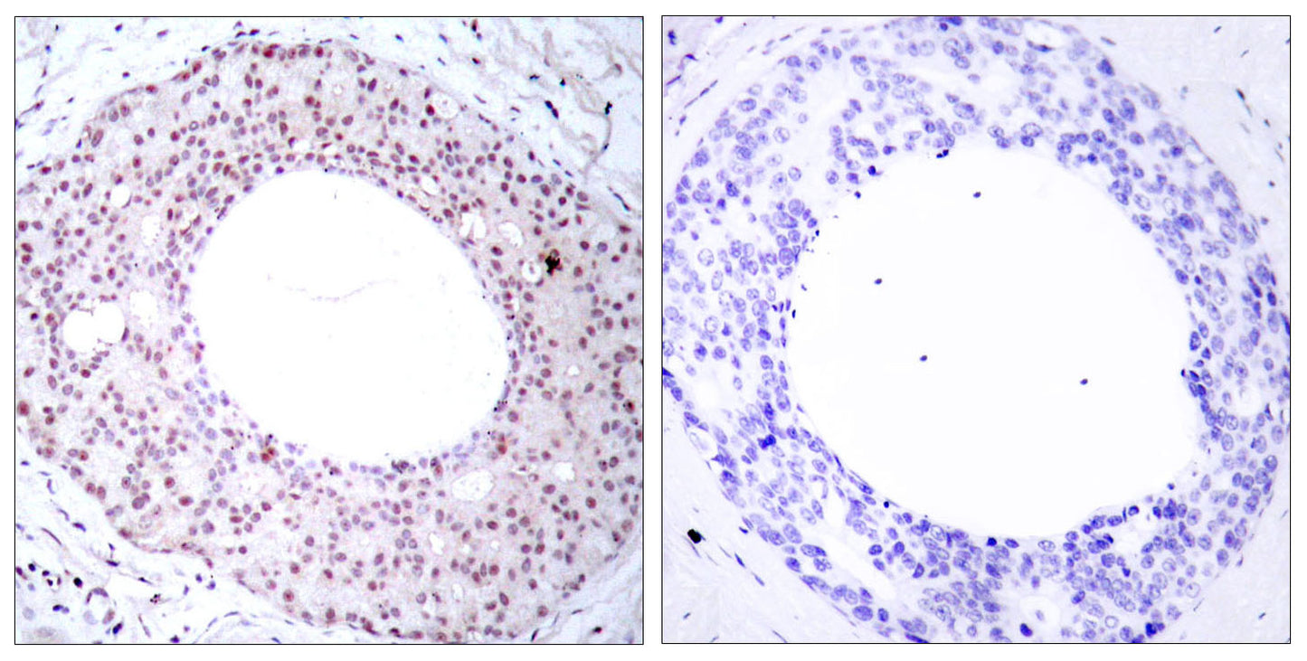 NFκB-p65 (phospho Thr254) Rabbit Polyclonal Antibody