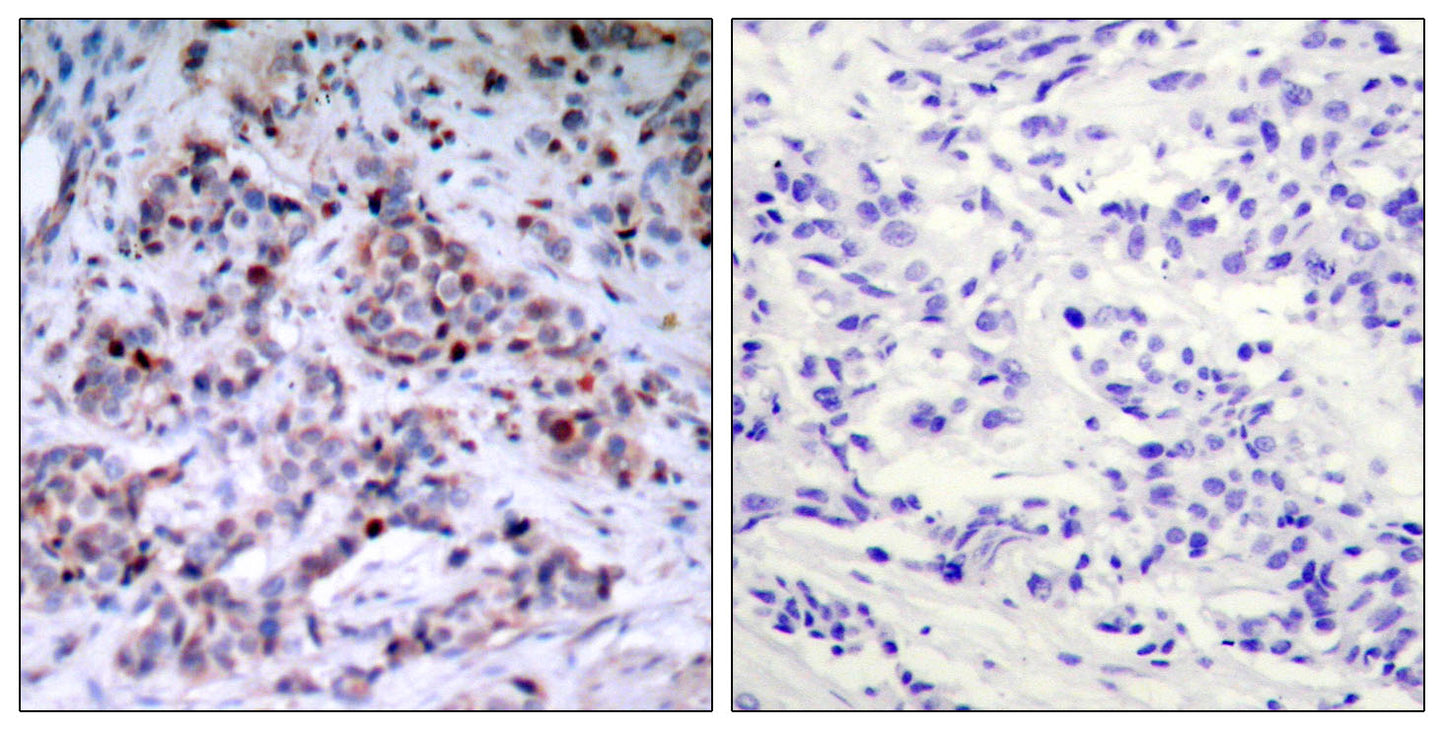 NFκB-p65 (phospho Thr435) Rabbit Polyclonal Antibody