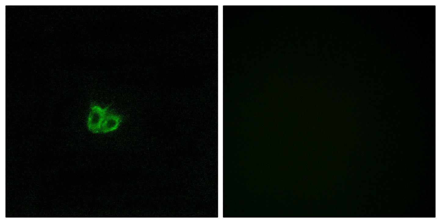 Op18 (phospho Ser16) Rabbit Polyclonal Antibody