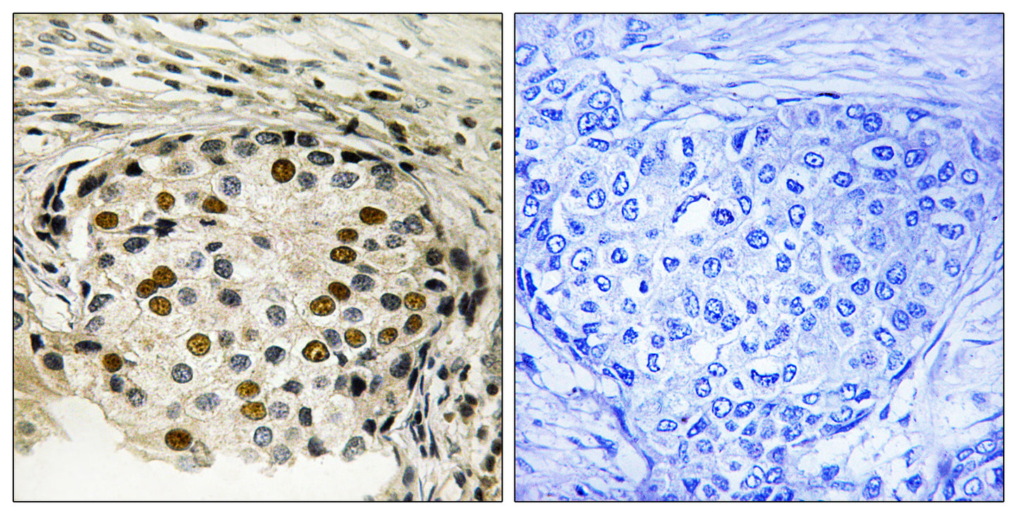 OSR1 (phospho Thr185) Rabbit Polyclonal Antibody