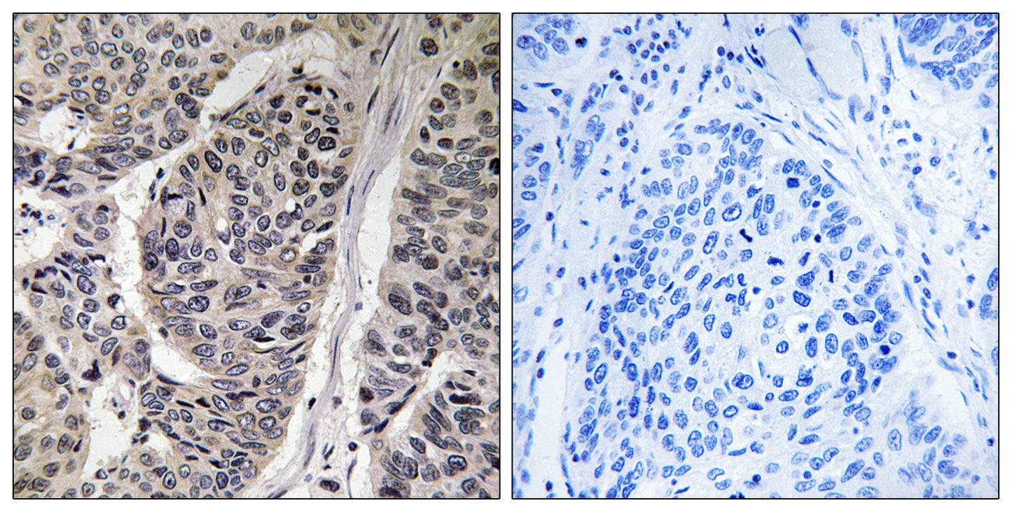 p130 Cas (phospho Tyr410) Rabbit Polyclonal Antibody