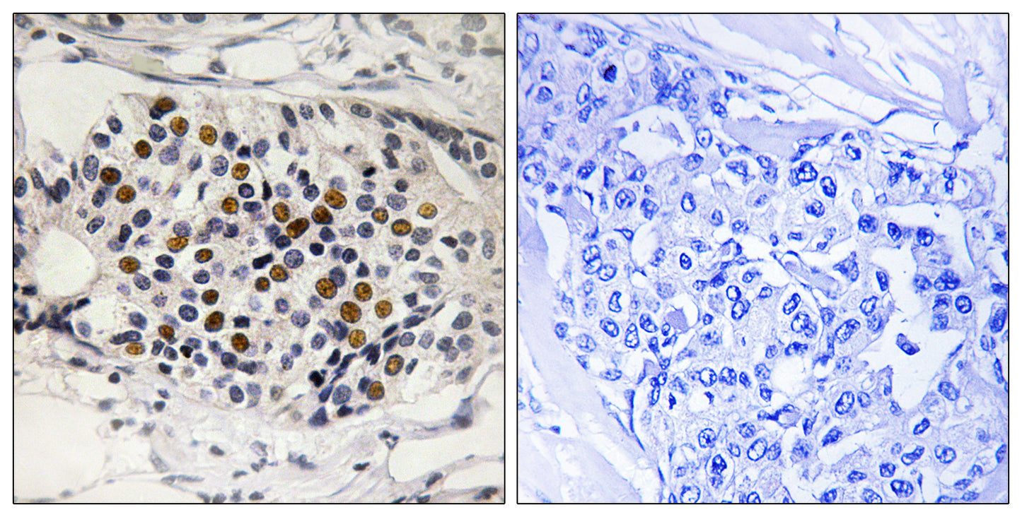 p16 (phospho Ser326) Rabbit Polyclonal Antibody