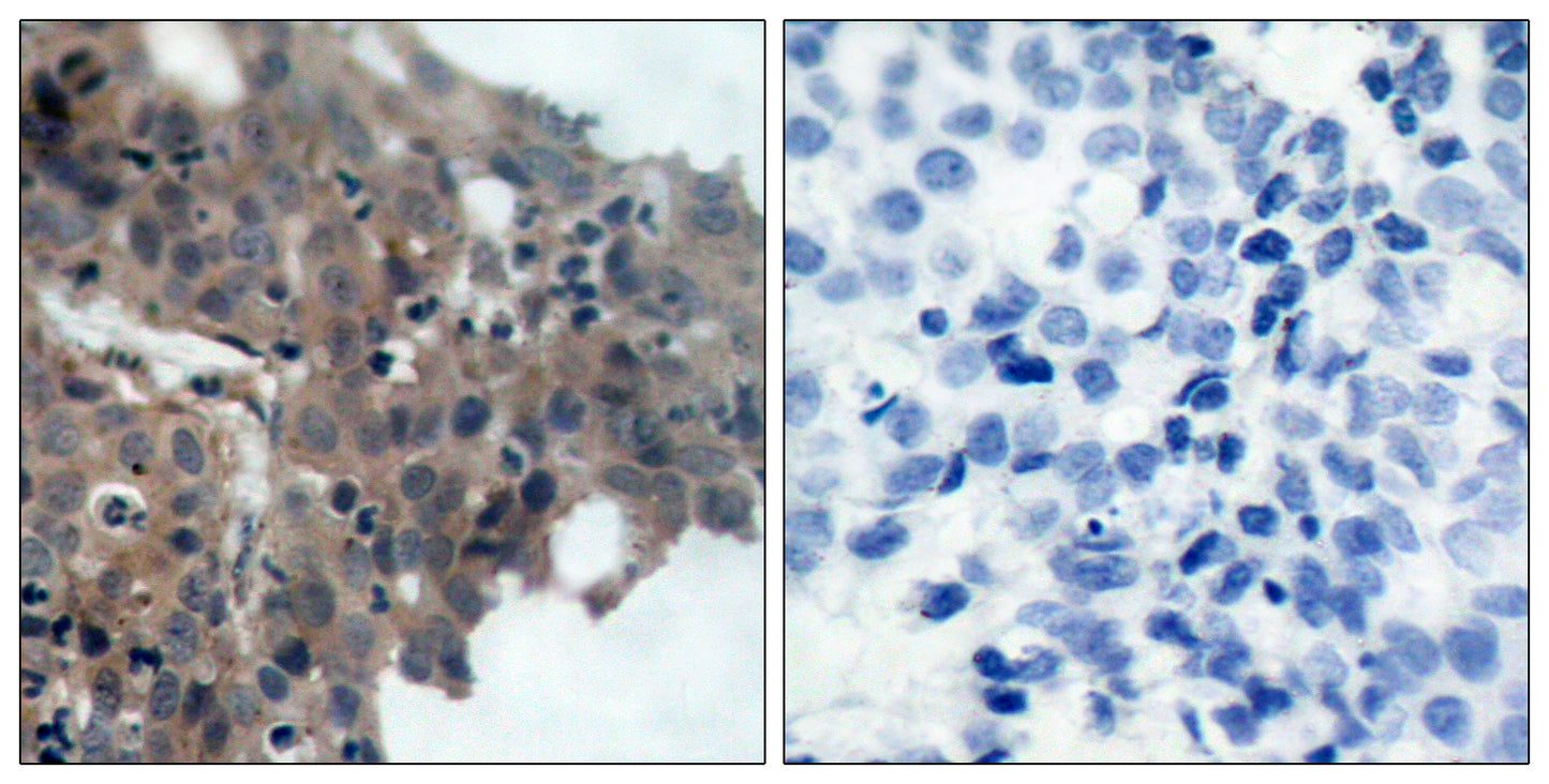 p21 (phospho Thr145) Rabbit Polyclonal Antibody