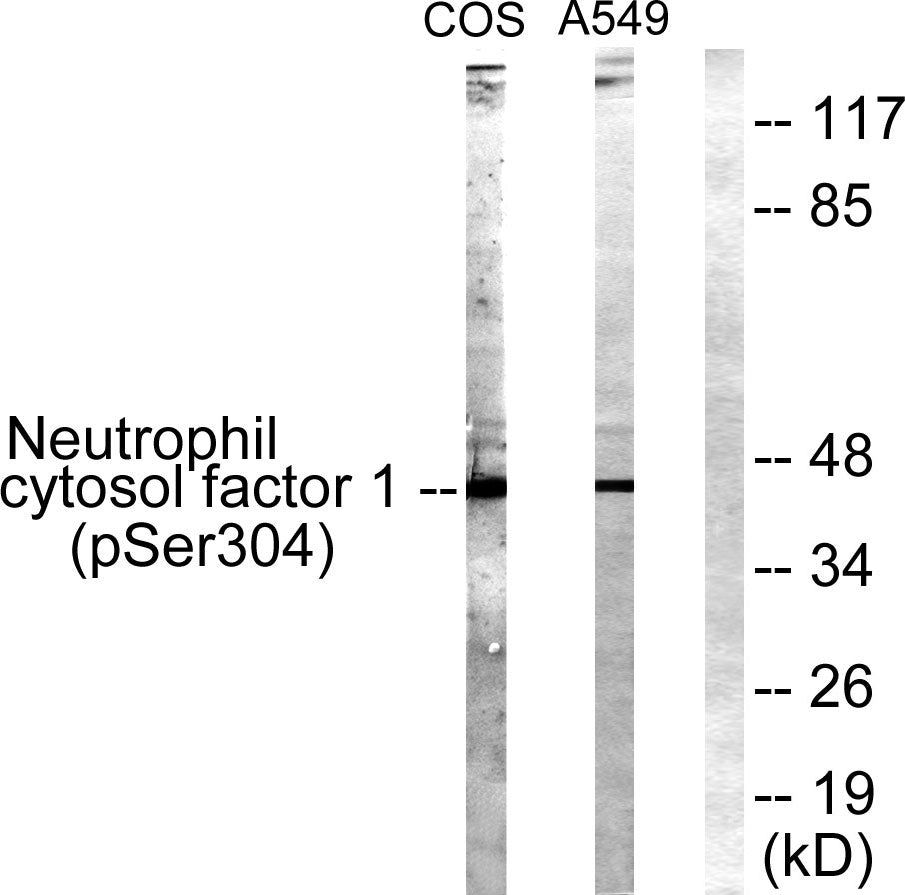 p47-phox (phospho Ser304) Rabbit Polyclonal Antibody