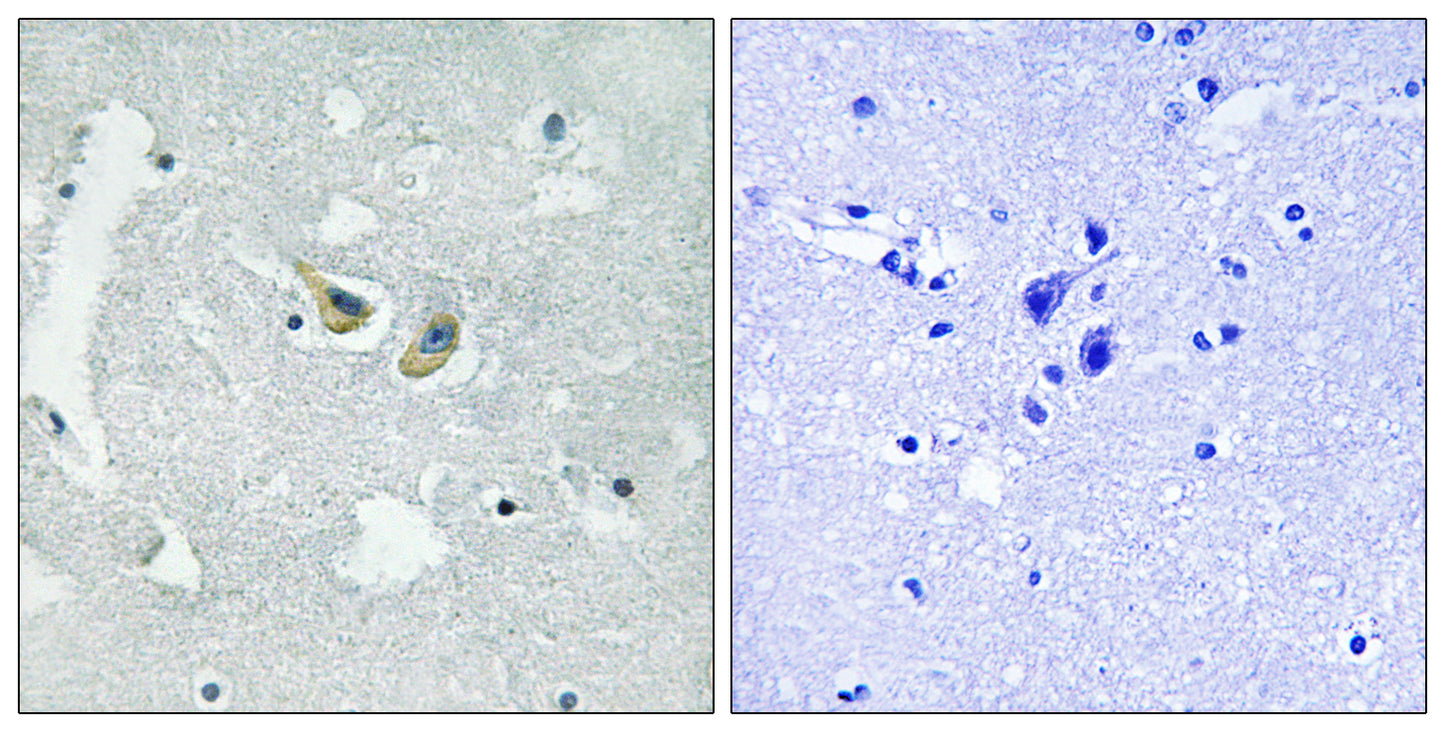p47-phox (phospho Ser345) Rabbit Polyclonal Antibody