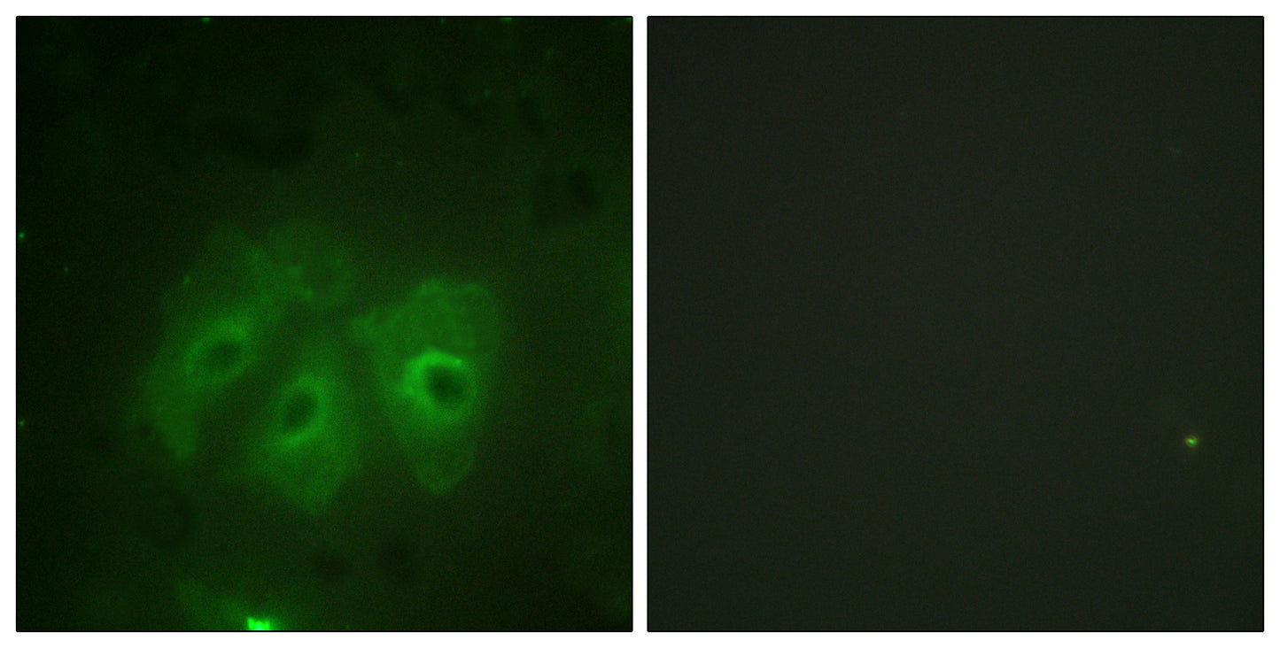 p47-phox (phospho Ser359) Rabbit Polyclonal Antibody