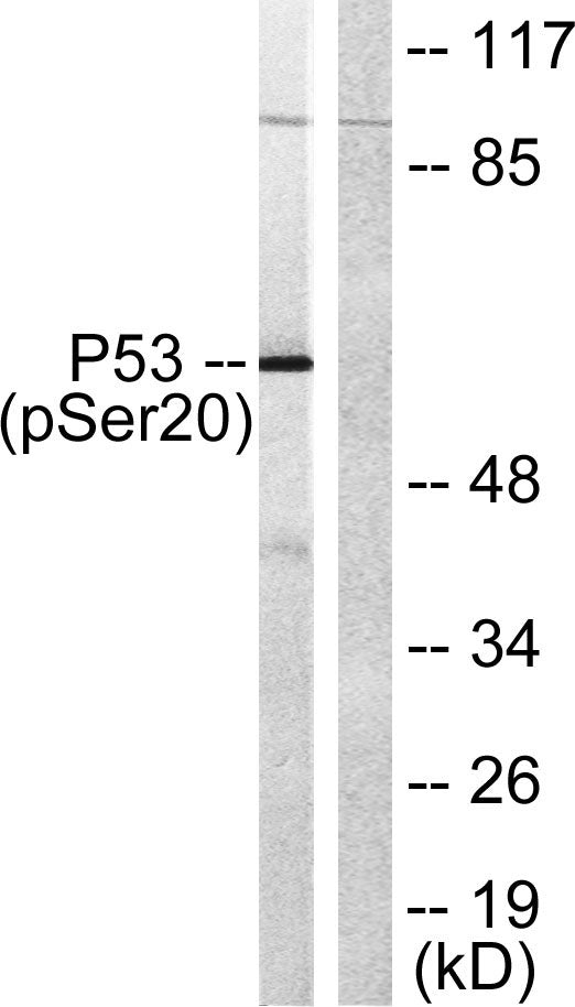p53 (phospho Ser20) Rabbit Polyclonal Antibody