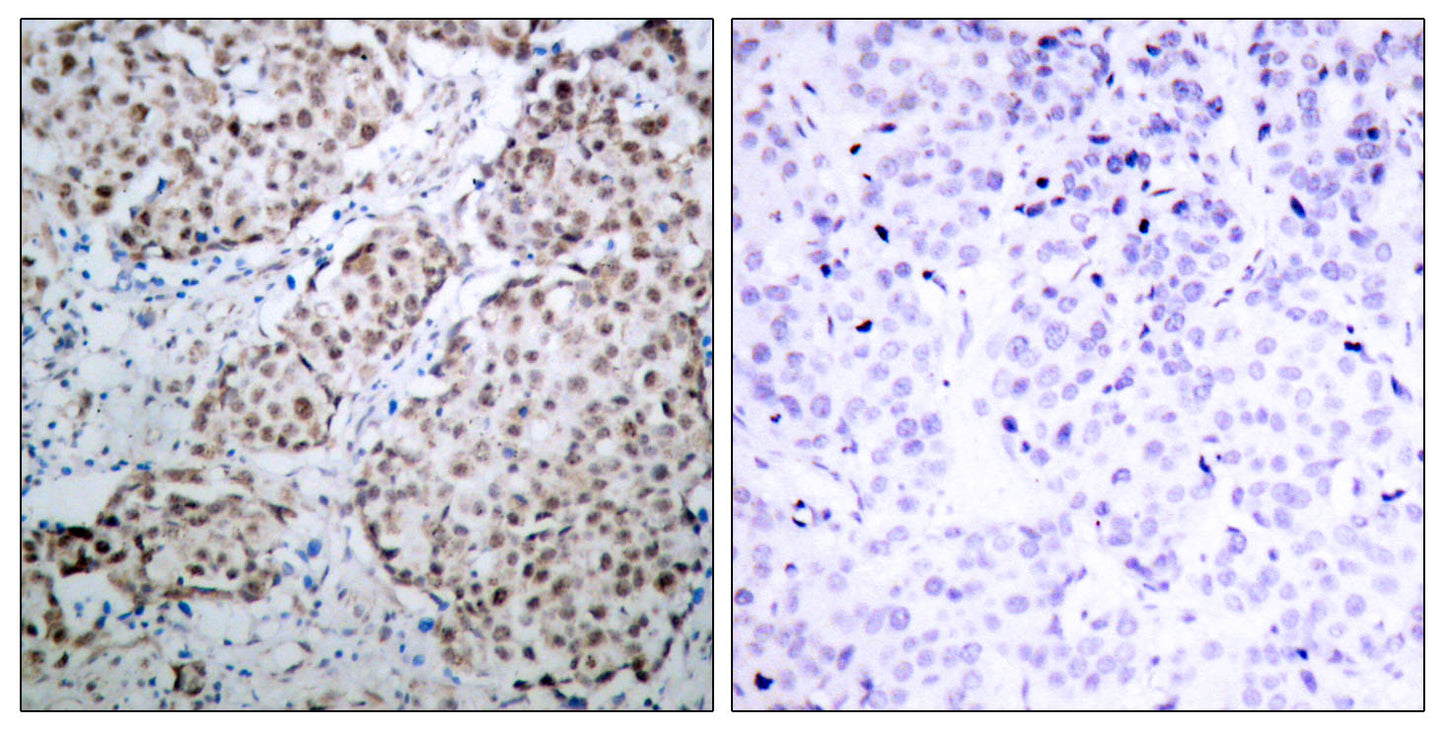 p53 (phospho Ser315) Rabbit Polyclonal Antibody