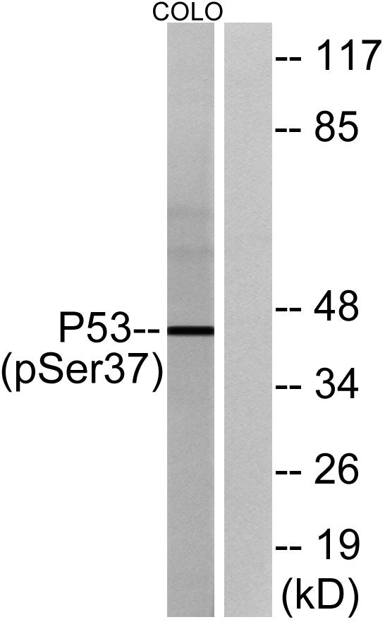 p53 (phospho Ser37) Rabbit Polyclonal Antibody
