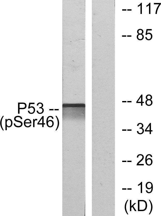 p53 (phospho Ser46) Rabbit Polyclonal Antibody