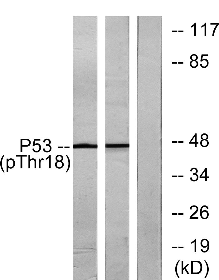 p53 (phospho Thr18) Rabbit Polyclonal Antibody