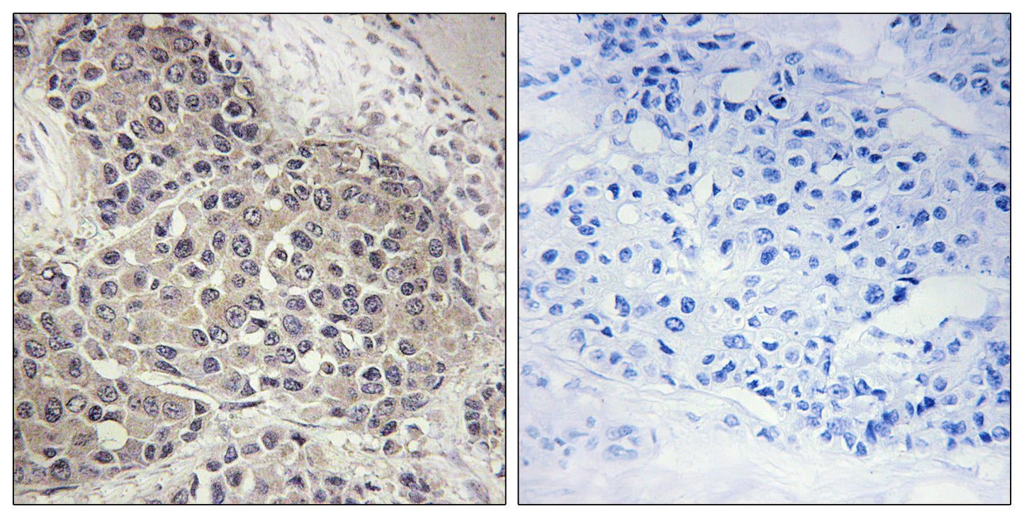 p70 S6 kinase α (phospho Ser447) Rabbit Polyclonal Antibody