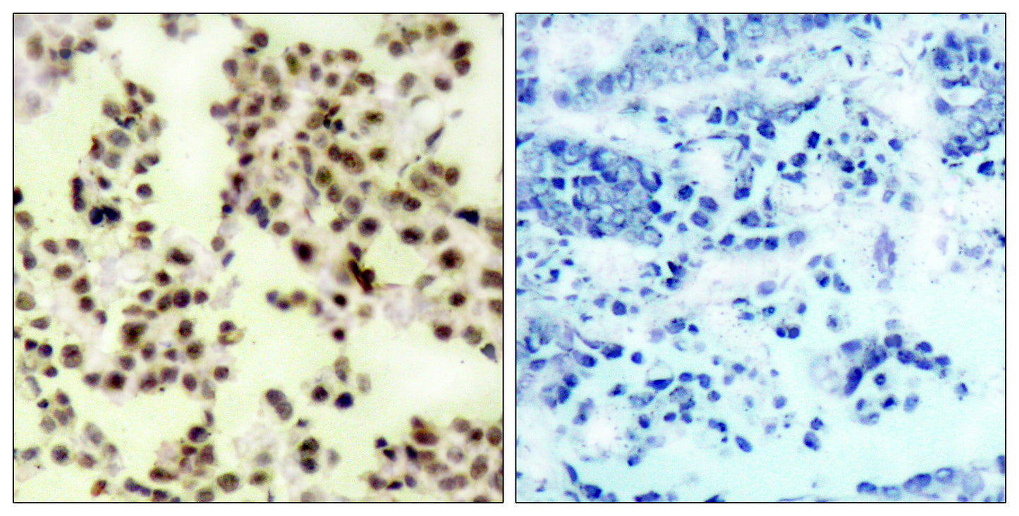 p73 (phospho Tyr99) Rabbit Polyclonal Antibody