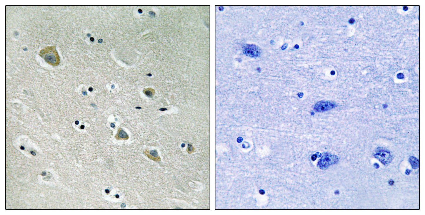 PAKα (phospho Ser204) Rabbit Polyclonal Antibody