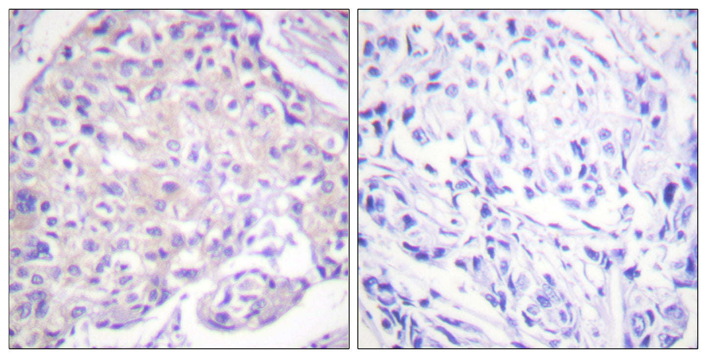PAKα (phospho Thr212) Rabbit Polyclonal Antibody