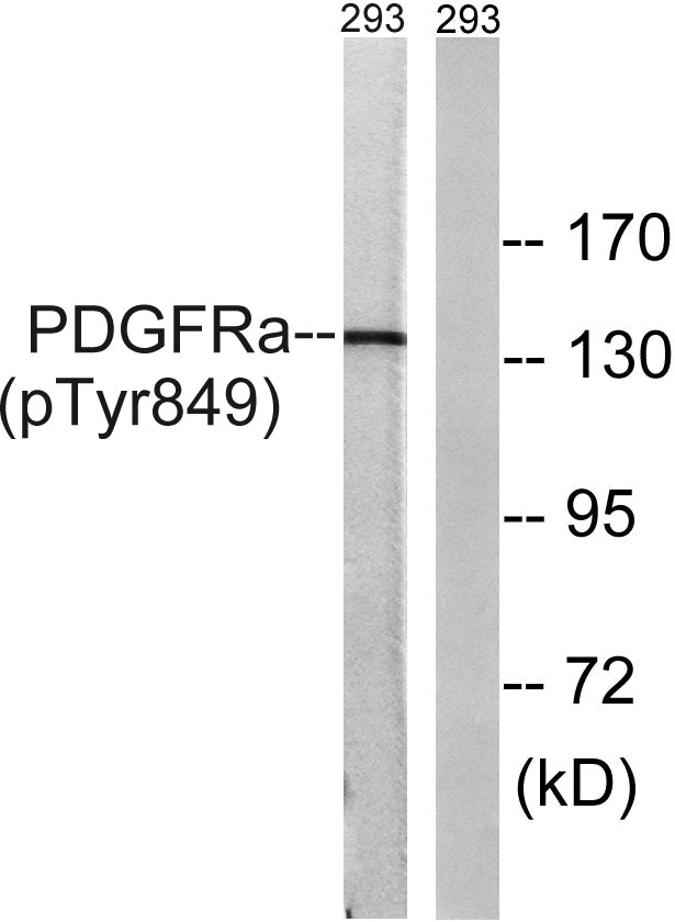 PDGFR-α (phospho Tyr849) Rabbit Polyclonal Antibody