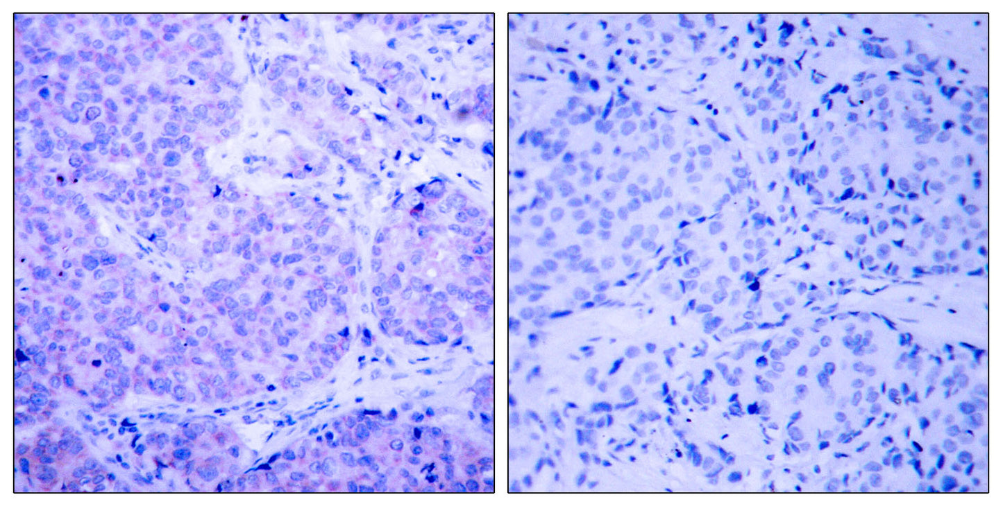 PDK1 (phospho Ser241) Rabbit Polyclonal Antibody