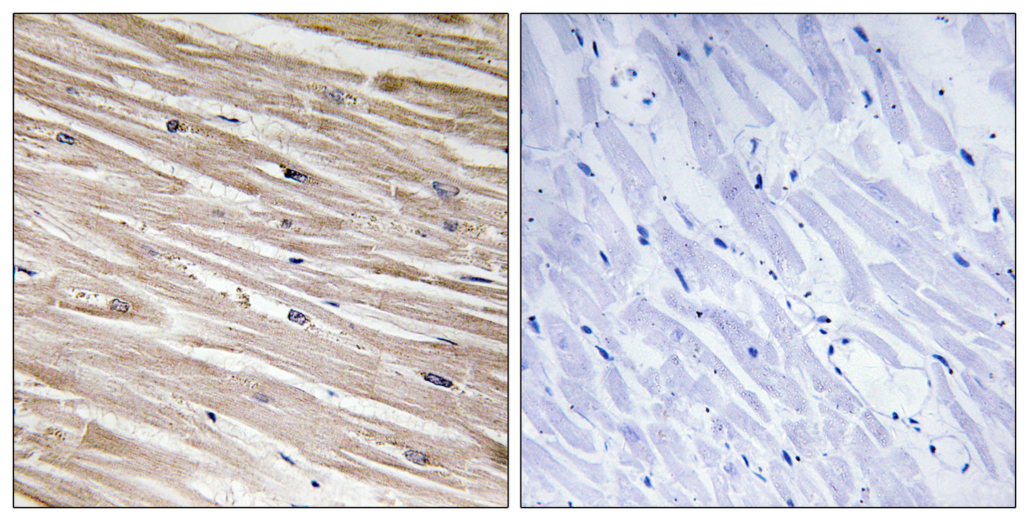 PEA-15 (phospho Ser104) Rabbit Polyclonal Antibody