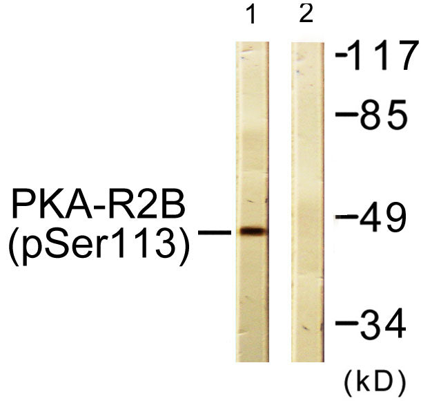 PKA IIβ reg (phospho Ser113) Rabbit Polyclonal Antibody