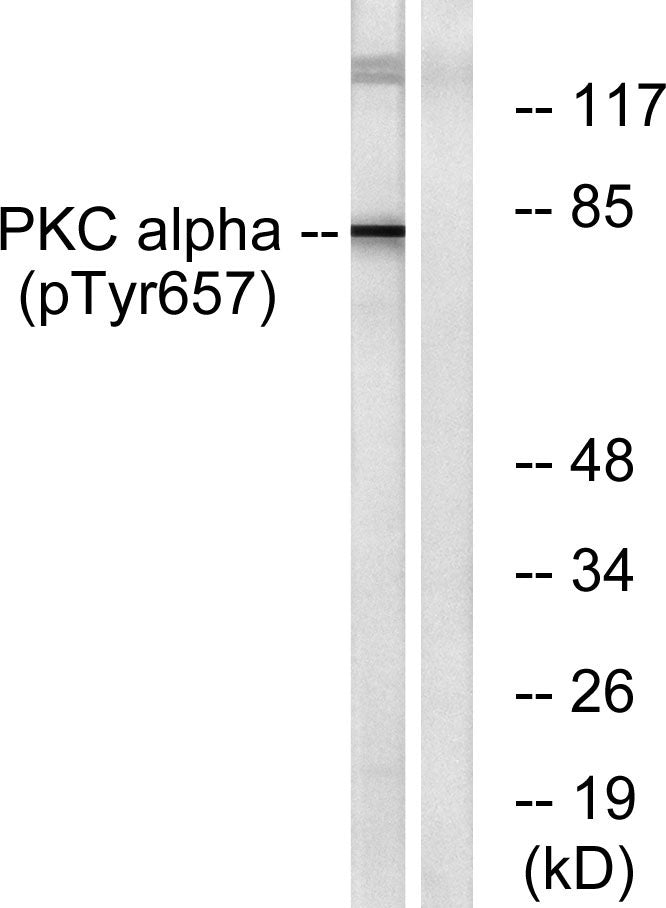 PKC α (phospho Tyr657) Rabbit Polyclonal Antibody
