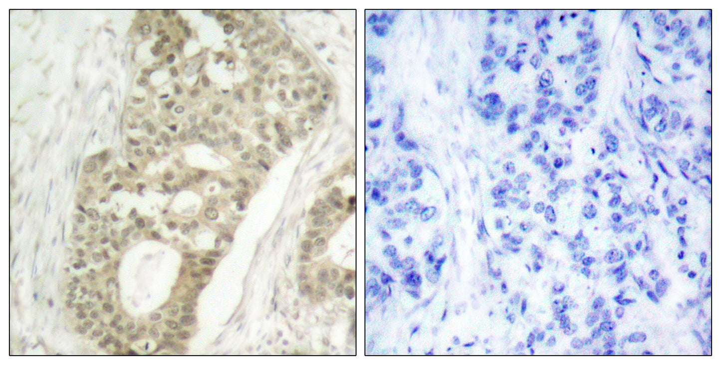 PKC δ (phospho Ser645) Rabbit Polyclonal Antibody