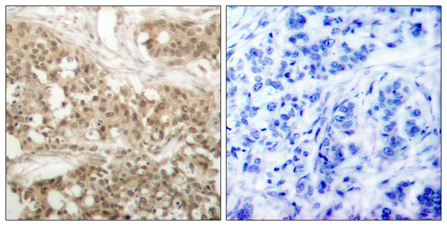 PKC θ (phospho Ser676) Rabbit Polyclonal Antibody