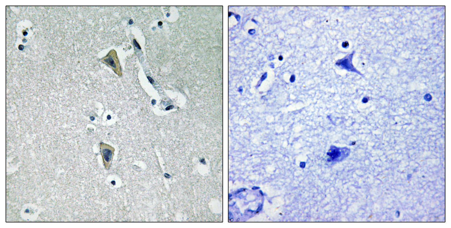 PKC θ (phospho Thr538) Rabbit Polyclonal Antibody