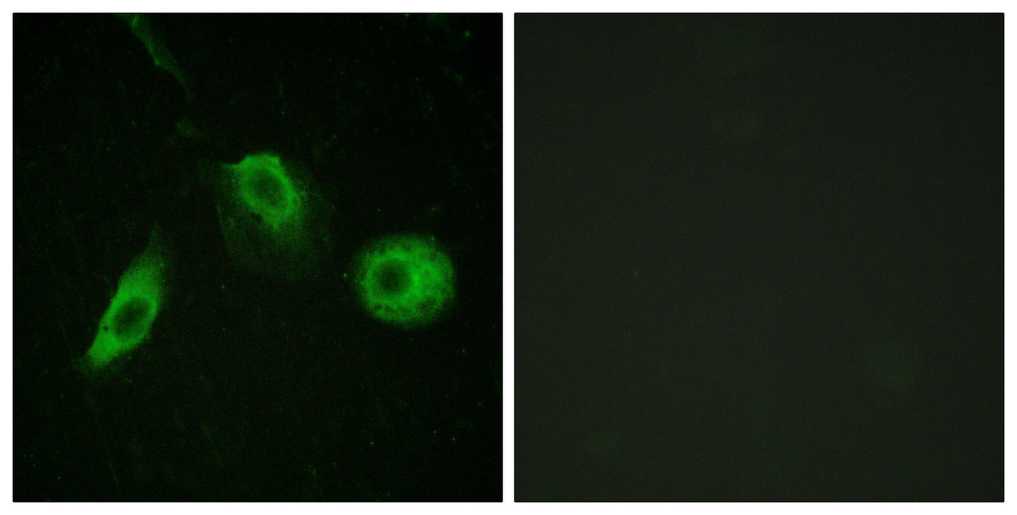 PLC γ2 (phospho Tyr1217) Rabbit Polyclonal Antibody