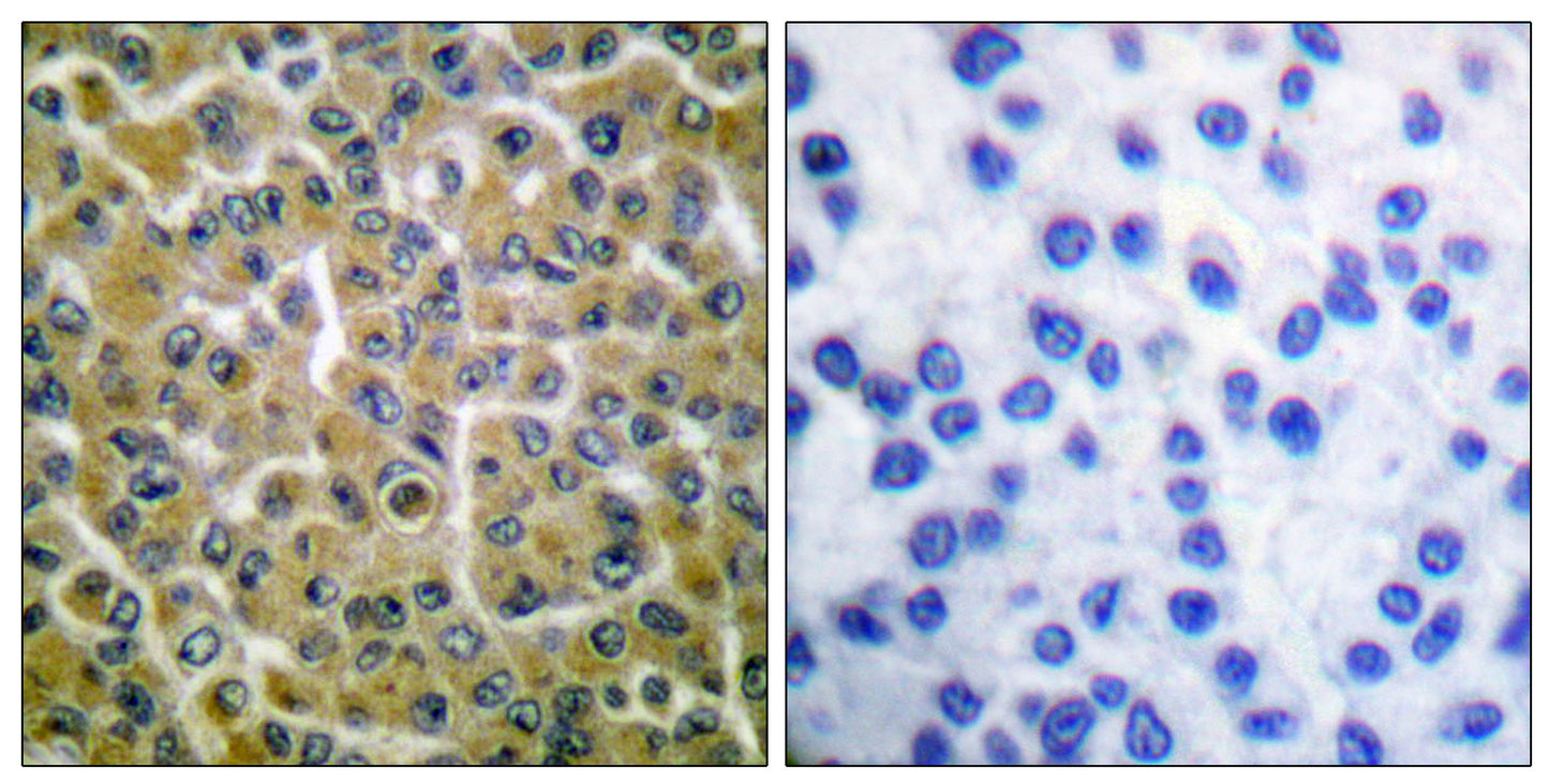 PLC γ2 (phospho Tyr753) Rabbit Polyclonal Antibody