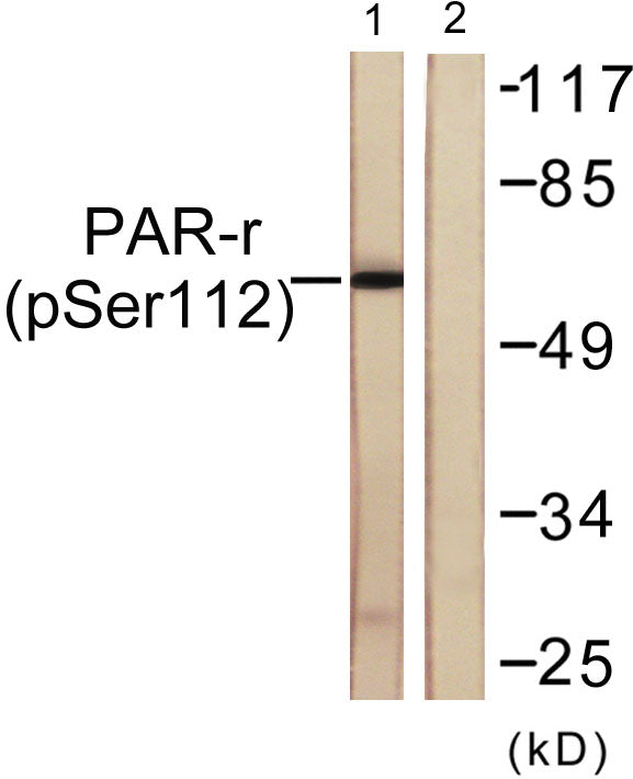 PPAR-γ (phospho Ser112) Rabbit Polyclonal Antibody