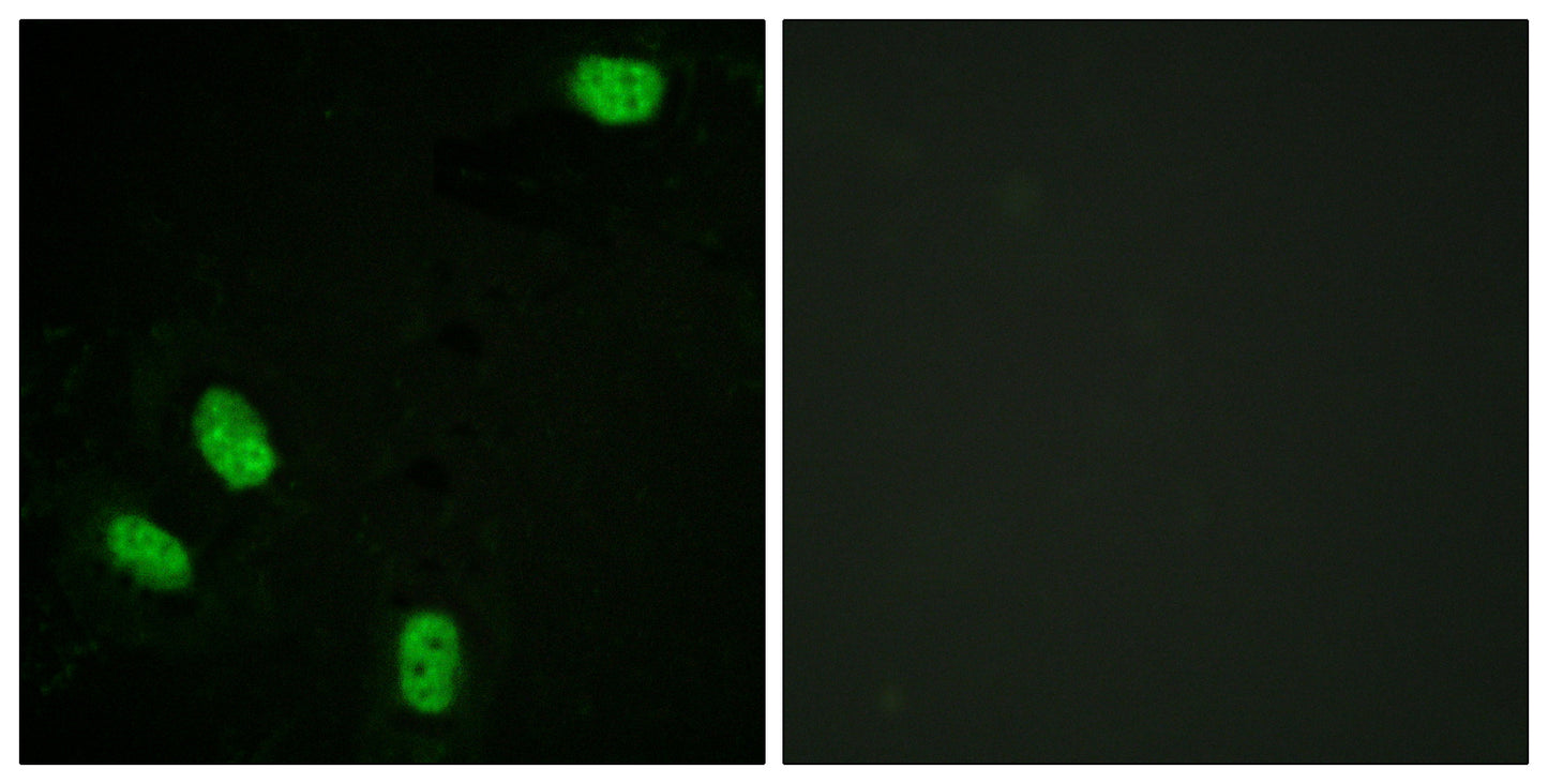 PR (phospho Ser294) Rabbit Polyclonal Antibody