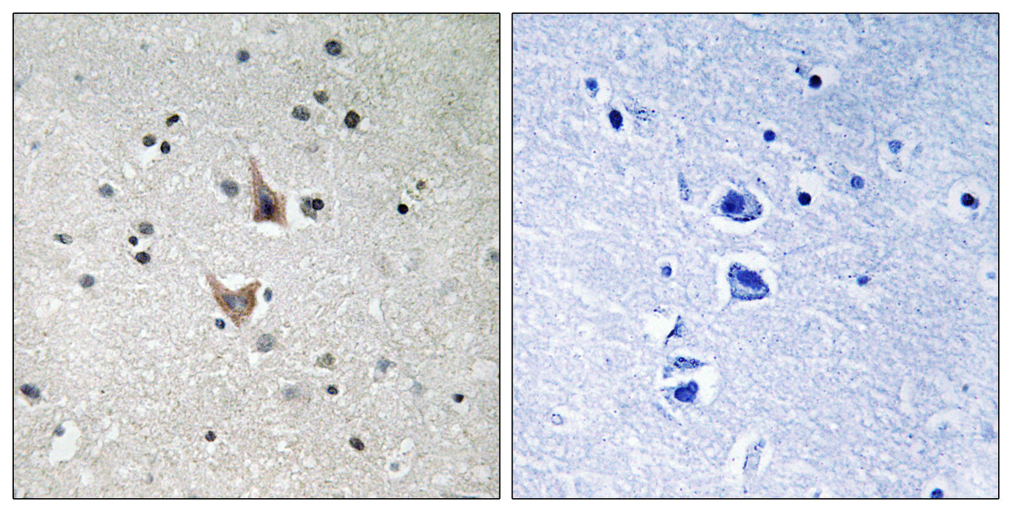 Presenilin 1 (phospho Ser357) Rabbit Polyclonal Antibody