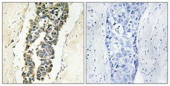 Presenilin 2 (phospho Ser330) Rabbit Polyclonal Antibody