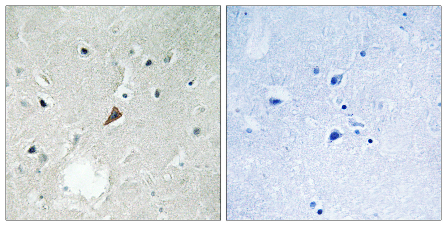 PYK2 (phospho Tyr579) Rabbit Polyclonal Antibody