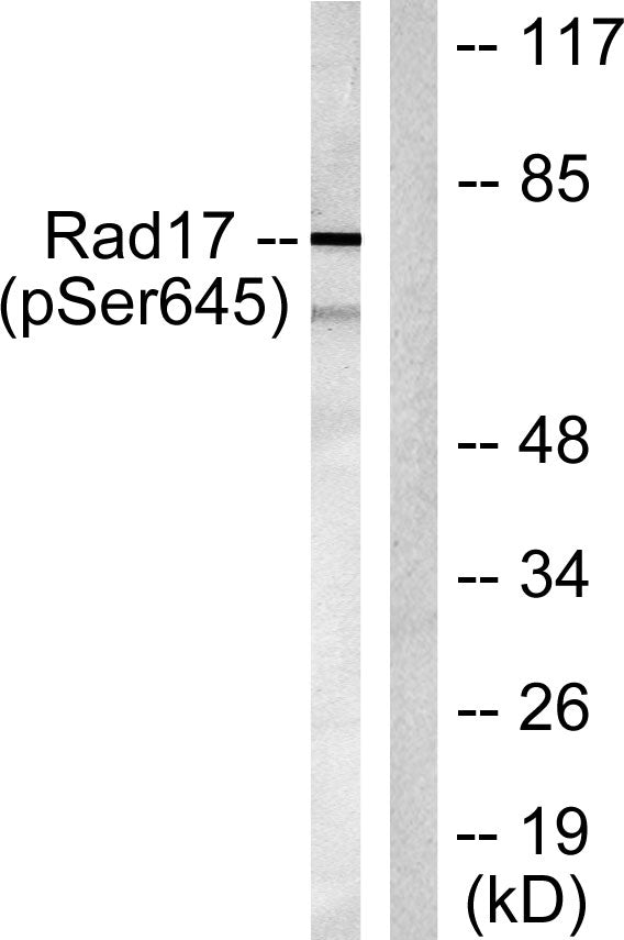 Rad17 (phospho Ser645) Rabbit Polyclonal Antibody