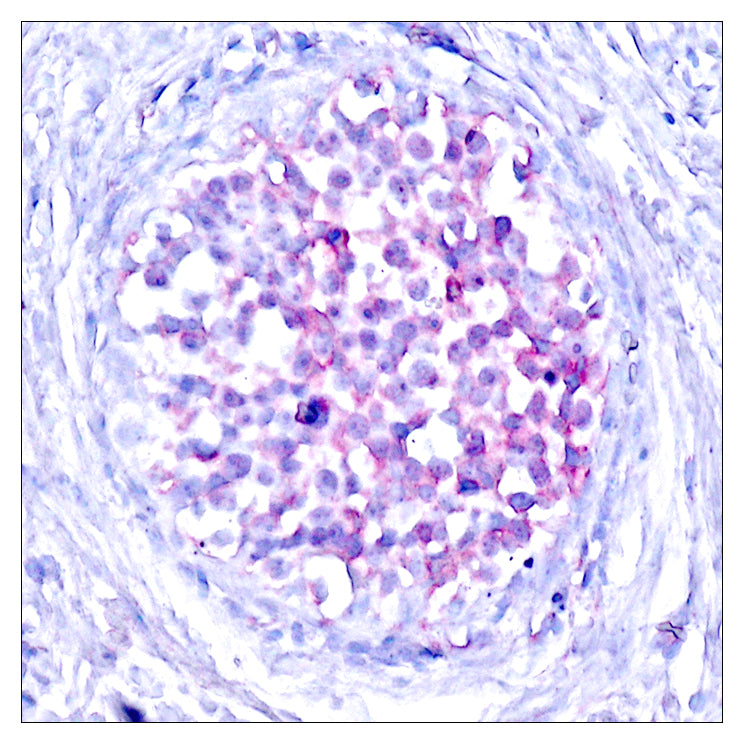 Raf-1 (phospho Ser259) Rabbit Polyclonal Antibody