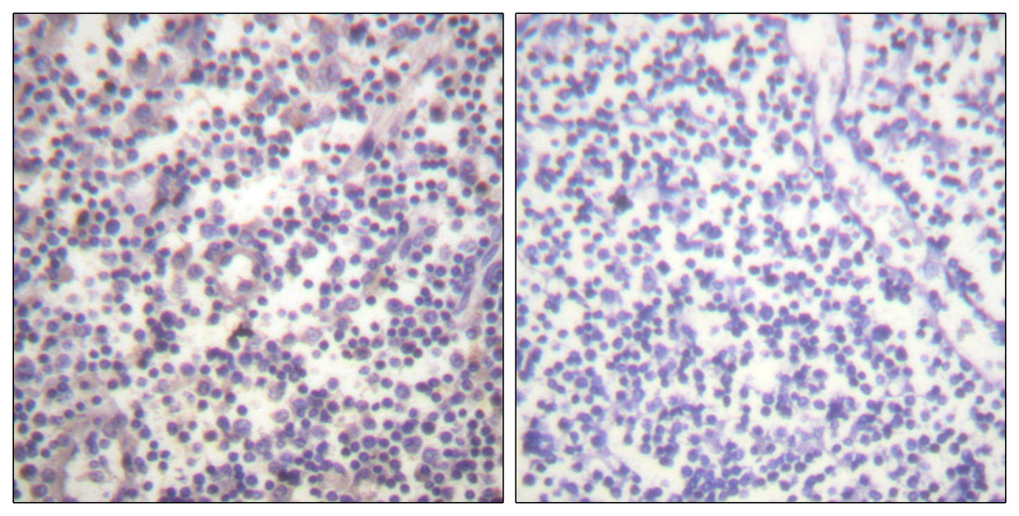 Raf-B (phospho Ser602) Rabbit Polyclonal Antibody
