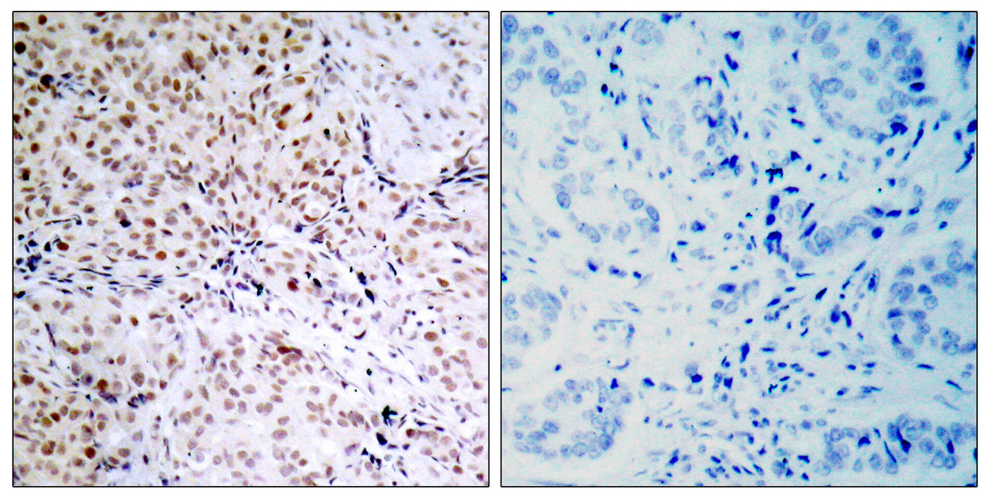 Rb (phospho Ser795) Rabbit Polyclonal Antibody
